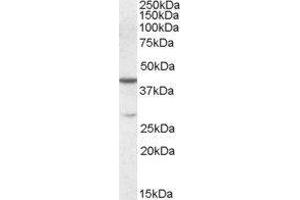 Western Blotting (WB) image for Chromobox Homolog 8 (CBX8) peptide (ABIN369764) (Chromobox Homolog 8 (CBX8) Peptide)