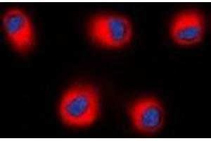 Immunofluorescent analysis of STEAP2 staining in HEK293T cells. (STEAP2 抗体  (C-Term))