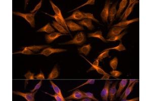 Immunofluorescence analysis of HeLa cells using UNG Polyclonal Antibody at dilution of 1:100. (UNG 抗体)