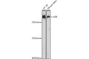 Western blot analysis of extracts of various cell lines, using ATR antibody (ABIN6131207, ABIN6137357, ABIN6137359 and ABIN6218135) at 1:500 dilution. (ATR 抗体  (AA 400-650))