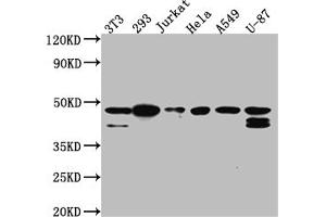 Western Blot Positive WB detected in: NIH/3T3 whole cell lysate, 293 whole cell lysate, Jurkat whole cell lysate, Hela whole cell lysate, A549 whole cell lysate, U-87 whole cell lysate All lanes: CKII alpha antibody at 1:1000 Secondary Goat polyclonal to rabbit IgG at 1/50000 dilution Predicted band size: 46, 30 kDa Observed band size: 45 kDa (Recombinant CSNK2A1/CK II alpha 抗体)
