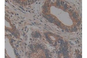 Immunohistochemistry (IHC) image for anti-Chemokine (C-X3-C Motif) Ligand 1 (CX3CL1) (AA 25-332) antibody (ABIN7438127)