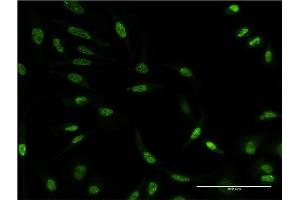 Immunofluorescence of monoclonal antibody to AKT3 on HeLa cell. (AKT3 抗体  (AA 100-189))