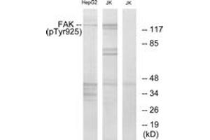 Western blot analysis of extracts from Jurkat and HepG2 cells, using FAK (Phospho-Tyr925) Antibody. (FAK 抗体  (pTyr925))