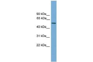 WB Suggested Anti-EFCAB3 Antibody Titration: 0. (EFCAB3 抗体  (N-Term))