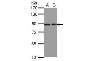 Image no. 2 for anti-Discoidin, CUB and LCCL Domain Containing 2 (DCBLD2) (AA 489-750) antibody (ABIN1497772) (DCBLD2 抗体  (AA 489-750))