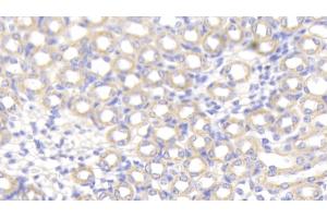 Detection of SPTAN1 in Mouse Kidney Tissue using Polyclonal Antibody to Alpha-Fodrin (SPTAN1) (SPTAN1 抗体  (AA 1049-1207))