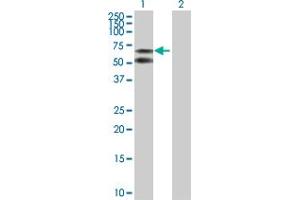 Western Blot analysis of ALB expression in transfected 293T cell line by ALB MaxPab polyclonal antibody. (Albumin 抗体  (AA 1-609))