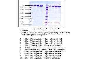 Gel Scan of Alpha 2 Macroglobulin, Human Plasma, Fast Form  This information is representative of the product ART prepares, but is not lot specific.