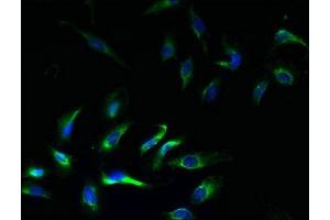 Immunofluorescent analysis of Hela cells using ABIN7145013 at dilution of 1:100 and Alexa Fluor 488-congugated AffiniPure Goat Anti-Rabbit IgG(H+L) (KCNJ1 抗体  (AA 178-391))