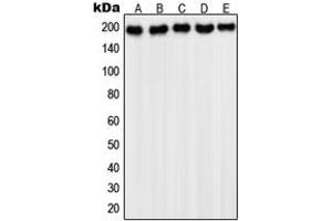 Western blot analysis of PDGFR alpha expression in HepG2 (A), NIH3T3 (B), Saos2 (C), HeLa (D), A431 (E) whole cell lysates. (PDGFRA 抗体  (C-Term))