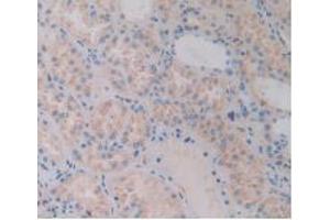 IHC-P analysis of Human Kidney Tissue, with DAB staining. (FLNC 抗体  (AA 17-259))