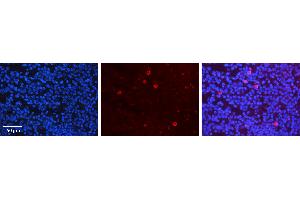 Rabbit Anti-CRKL Antibody Catalog Number: ARP30524_P050 Formalin Fixed Paraffin Embedded Tissue: Human Lymph Node Tissue Observed Staining: Plasma membrane, Cytoplasm Primary Antibody Concentration: 1:100 Other Working Concentrations: 1:600 Secondary Antibody: Donkey anti-Rabbit-Cy3 Secondary Antibody Concentration: 1:200 Magnification: 20X Exposure Time: 0. (CrkL 抗体  (Middle Region))