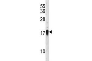 CD70 antibody western blot analysis in NCI-H460 lysate (CD70 抗体  (AA 72-101))