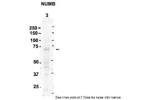 Sample Type: 3. (NUMB 抗体  (C-Term))
