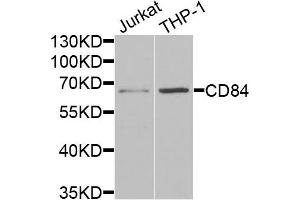 Western blot analysis of extracts of Jurkat and THP1 cells, using CD84 antibody. (CD84 抗体)