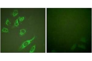Immunofluorescence analysis of HeLa cells treated with PMA 125ng/ml 30', using 14-3-3 zeta (Phospho-Ser58) Antibody. (14-3-3 zeta 抗体  (pSer58))