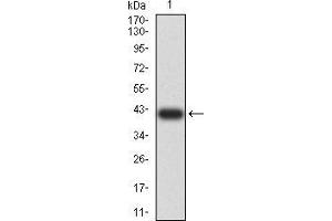 Western blot analysis using C3C mAb against human C3C (AA: 1521-1649) recombinant protein. (Complement C3c 抗体  (AA 1521-1649))