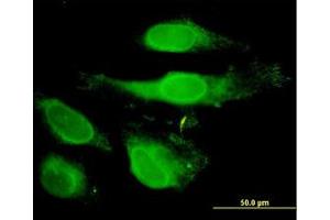 Image no. 3 for anti-Peroxiredoxin 2 (PRDX2) (AA 1-199) antibody (ABIN598967) (Peroxiredoxin 2 抗体  (AA 1-199))