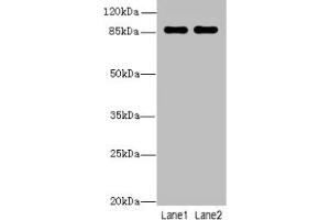 Western blot All lanes: VWA5A antibody at 1 μg/mL Lane 1: A549 whole cell lysate Lane 2: MCF-7 whole cell lysate Secondary Goat polyclonal to rabbit IgG at 1/10000 dilution Predicted band size: 87, 48, 46, 30 kDa Observed band size: 87 kDa (VWA5A 抗体  (AA 1-415))
