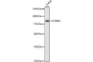Western blot analysis of extracts of Jurkat cells, using FOXK2 antibody (ABIN7267238) at 1:1000 dilution. (Forkhead Box K2 抗体  (AA 511-660))