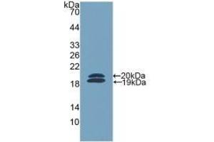 Detection of Recombinant FCN2, Mouse using Polyclonal Antibody to Ficolin 2 (FCN2) (Ficolin 2 抗体  (AA 97-254))