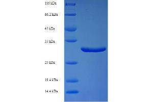 SDS-PAGE (SDS) image for Calmodulin-Like 5 (CALML5) (AA 2-146) protein (His-SUMO Tag) (ABIN5712021)