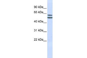 WB Suggested Anti-PIGQ Antibody Titration:  0. (PIGQ 抗体  (N-Term))