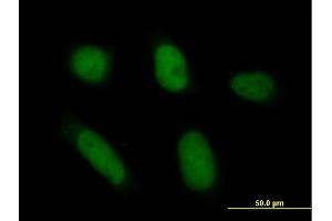 Immunofluorescence of purified MaxPab antibody to ANXA5 on HeLa cell. (Annexin V 抗体  (AA 1-320))