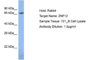 Host: Rabbit Target Name: ZNF12 Sample Type: 721_B Whole Cell lysates Antibody Dilution: 1. (ZNF12 抗体  (N-Term))