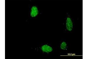 Immunofluorescence of purified MaxPab antibody to PIR on HeLa cell. (Pirin 抗体  (AA 1-290))