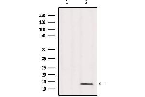 Western blot analysis of extracts from Mouse heart, using L36mt Antibody. (MRPL36 抗体  (Internal Region))