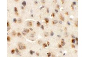 Immunohistochemical staining of mouse brain cells with AP3M1 polyclonal antibody  at 5 ug/mL. (AP3M1 抗体  (C-Term))