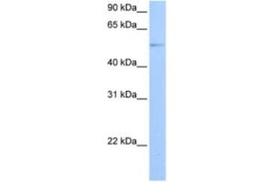 Western Blotting (WB) image for anti-G Protein-Coupled Receptor Kinase 4 (GRK4) antibody (ABIN2463568)