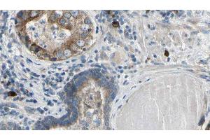 ABIN6279398 at 1/100 staining Human prostate tissue by IHC-P. (RNF41 抗体  (Internal Region))