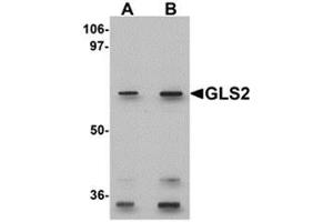 Western blot analysis of GLS2 in rat kidney tissue lysate with GLS2 antibody at (A) 0.