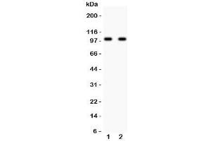 Western blot testing of GLUR2 antibody and Lane 1:  rat brain;  2: mouse brain lysate. (GRIA2 抗体  (AA 25-360))