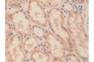 Immunohistochemistry (IHC) image for anti-Ornithine Decarboxylase 1 (ODC1) (AA 15-259) antibody (ABIN7433486)