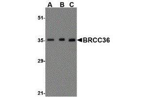Western Blotting (WB) image for anti-BRCA1/BRCA2-Containing Complex, Subunit 3 (BRCC3) (N-Term) antibody (ABIN2477712) (BRCC3 抗体  (N-Term))