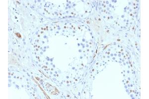 Formalin-fixed, paraffin-embedded human Testis stained with Wilm's Tumor Mouse Monoclonal Antibody (6F-H2). (WT1 抗体  (AA 1-181))