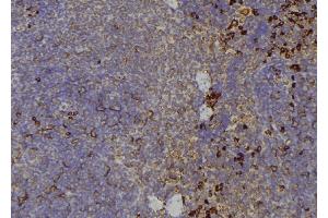 ABIN6267197 at 1/100 staining Human lymph node tissue by IHC-P. (TEK 抗体  (pTyr992))