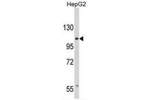 Western Blotting (WB) image for anti-Calcium Channel, Voltage-Dependent, alpha 2/delta Subunit 3 (CACNA2D3) (C-Term) antibody (ABIN950991)