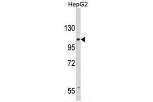 Western blot analysis of CACNA2D3 Antibody (C-term) in HepG2 cell line lysates (35µg/lane). (CACNA2D3 抗体  (C-Term))