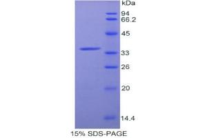 SDS-PAGE analysis of Rat aZGP1 Protein. (AZGP1 蛋白)