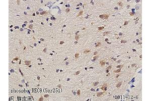Formalin-fixed and paraffin embedded rat brain tissue labeled with Anti phospho-REC8(Ser251) Polyclonal Antibody, Unconjugated (ABIN872285) followed by conjugation to the secondary antibody and DAB staining (REC8 抗体  (pSer251))