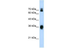 Western Blot showing KEAP1 antibody used at a concentration of 1-2 ug/ml to detect its target protein. (KEAP1 抗体  (C-Term))