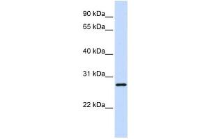 Western Blotting (WB) image for anti-TGFB-Induced Factor Homeobox 2-Like, X-Linked (TGIF2LX) antibody (ABIN2458211) (TGIF2LX 抗体)