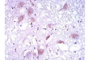 Immunohistochemistry (IHC) image for anti-DKK3 (AA 91-350) antibody (ABIN1098142)