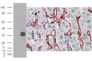 Immunohistochemistry (IHC) image for anti-Fc gamma RII (CD32) (C-Term) antibody (ABIN2465516) (Fc gamma RII (CD32) (C-Term) 抗体)