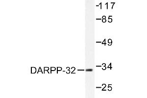 Image no. 1 for anti-Protein Phosphatase 1, Regulatory (Inhibitor) Subunit 1B (PPP1R1B) antibody (ABIN271882) (DARPP32 抗体)